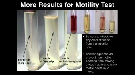 motility test are conducted with soft gel media|motility test protocol.